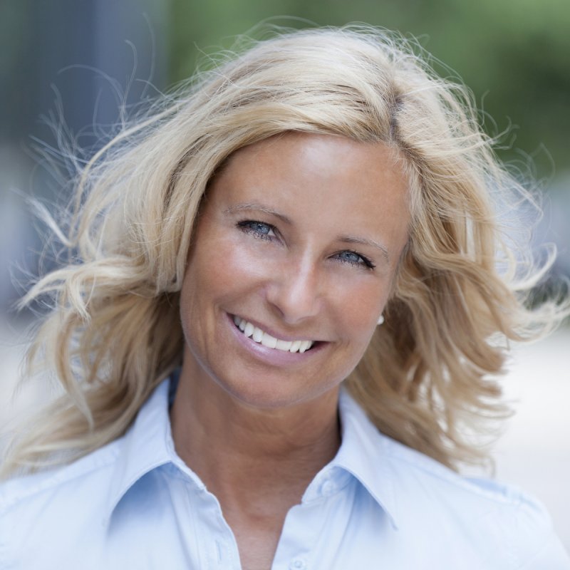 Instalift is a nonsurgical option for women with facial volume loss