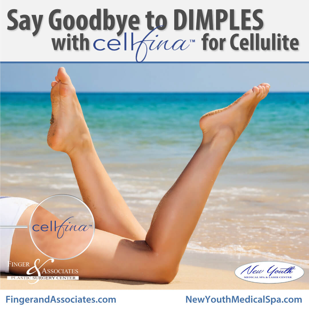 beautiful butt and legs for the beach is possible with Cellfina for Cellulite
