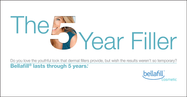 Bellafill the 5 year Filler to make you look youthful and natural