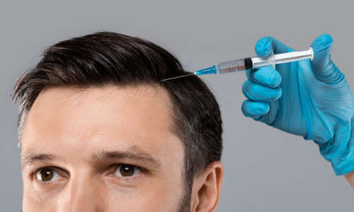 Mesotherapy for hair. Closeup of young man getting injections in head, grey panorama background. Millennial man having mesotherapy session at beauty salon, therapist in protective glove with syringe