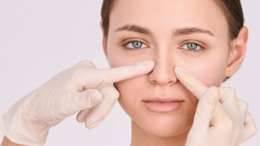 Nose Job Procedure with Dr. Ronald E Finger