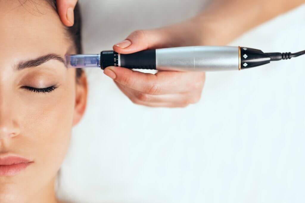 Is-A-SkinPen-Microneedling-Procedure-Right-1024x683-1 -SkinPen-Microneedling