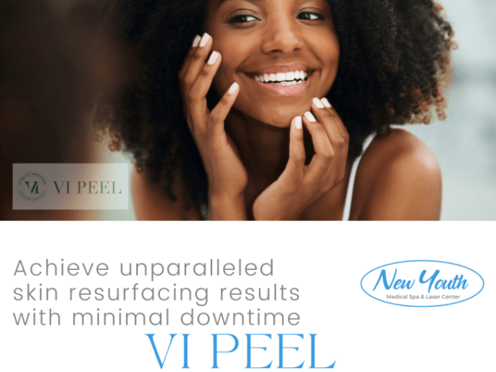 ViPeel at New Youth Skin Medical Spa