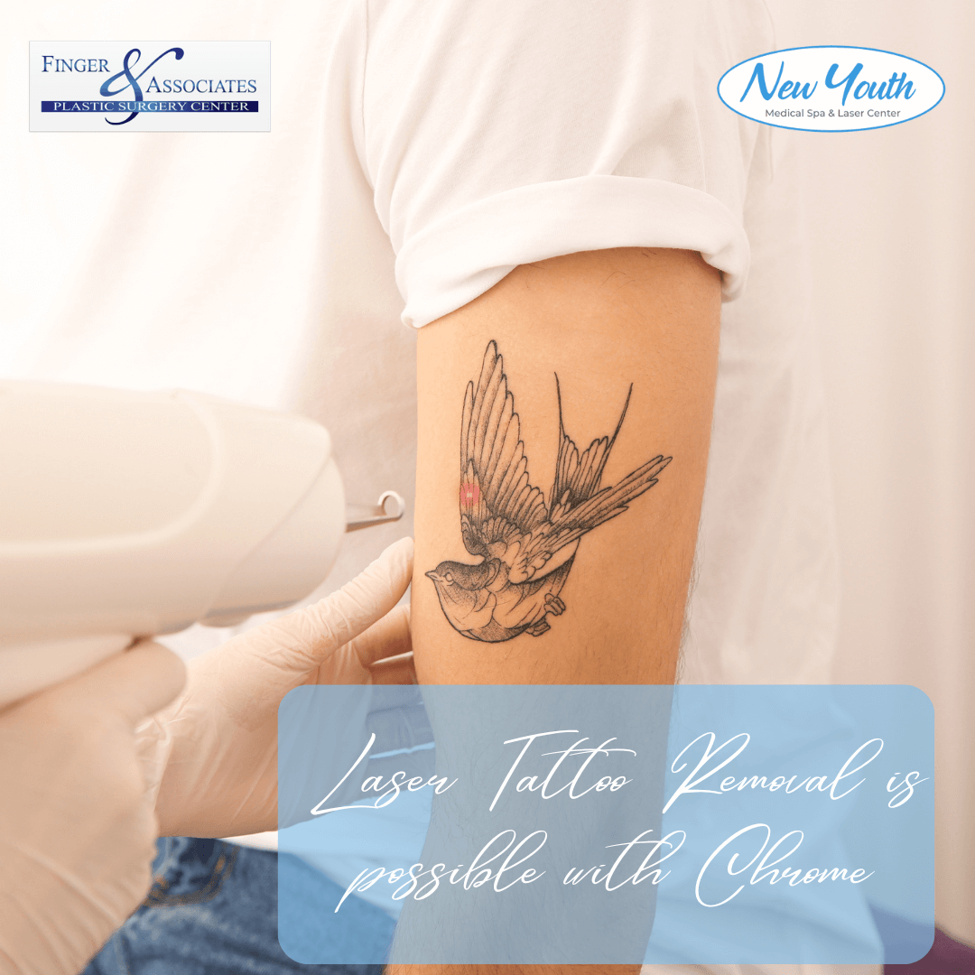 Tattoo Removal with Chrome Lase Station