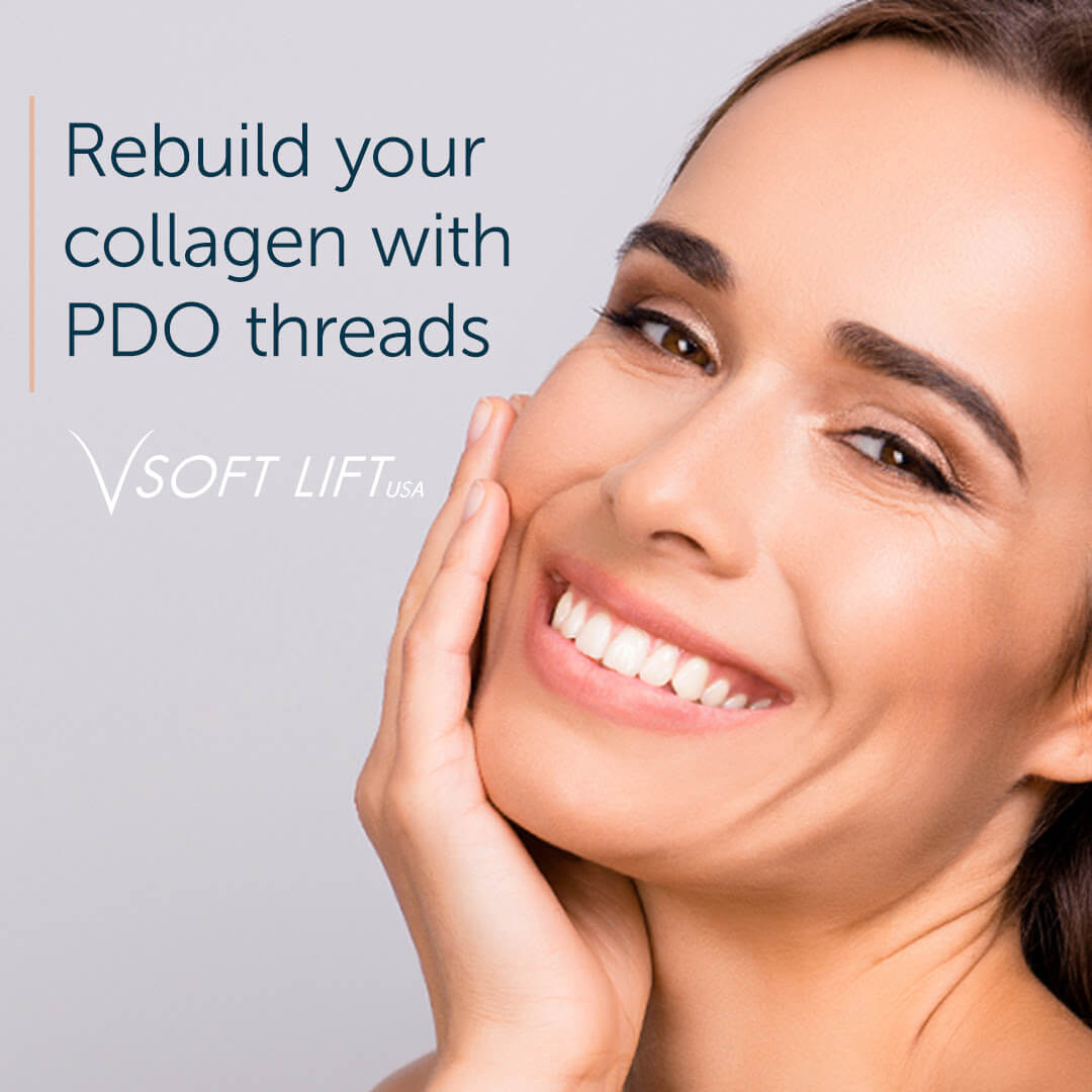 Rebuild-your-collagen-with-PDO-threads - V soft Lift at Finger and Associates 