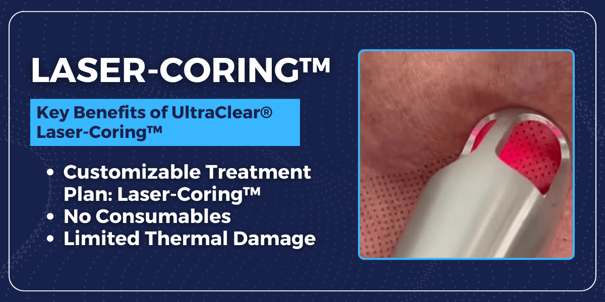 Key Benefits of Ultra Clear Laser Coring